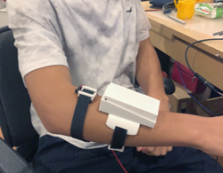 prosthetic hand with artificial intelligence